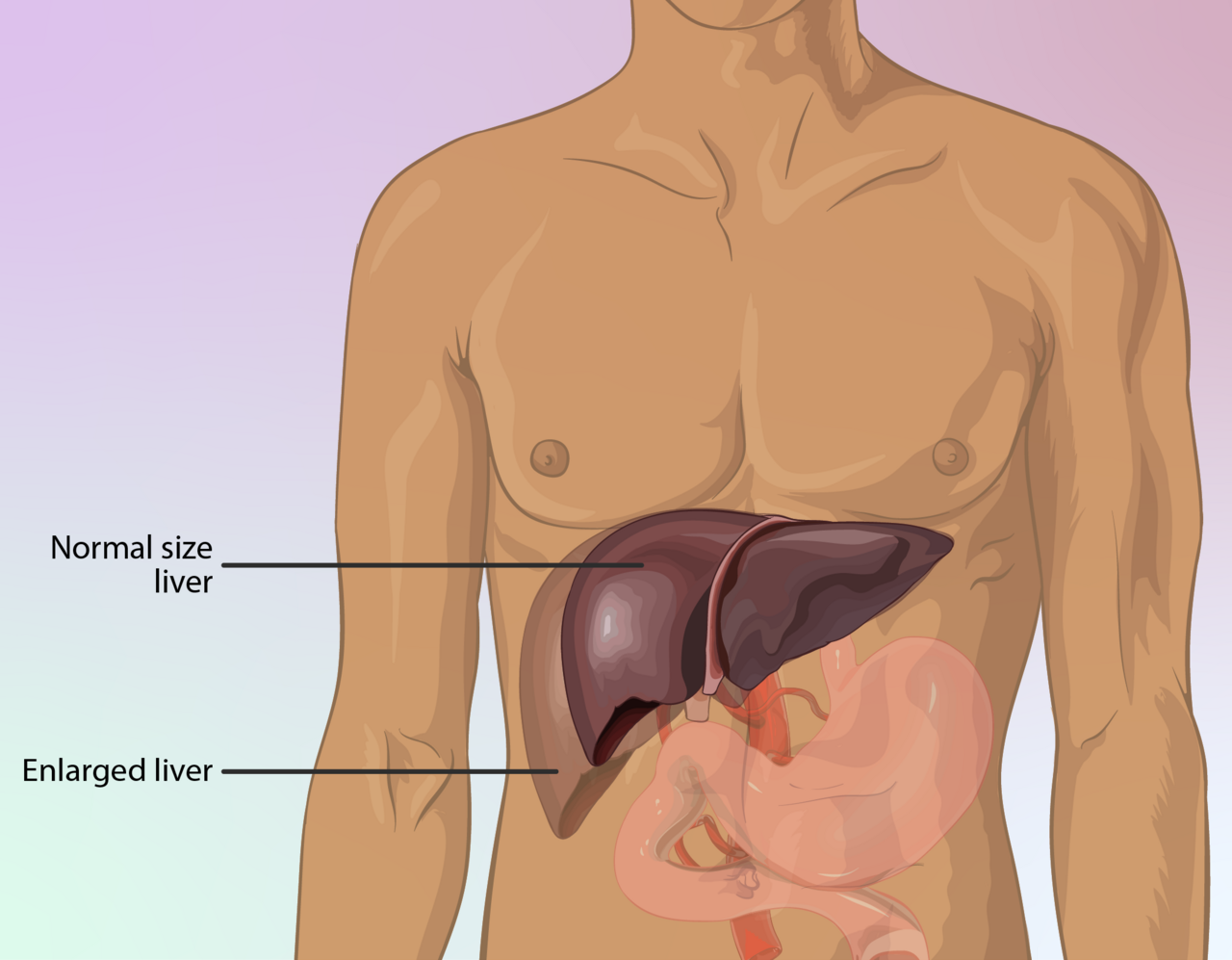 Liver Disease Symptoms